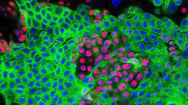Protein kan bromsa tumörers tillväxt i tarmen