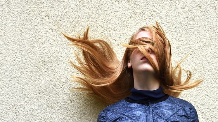 Alopecia – hvad er det?