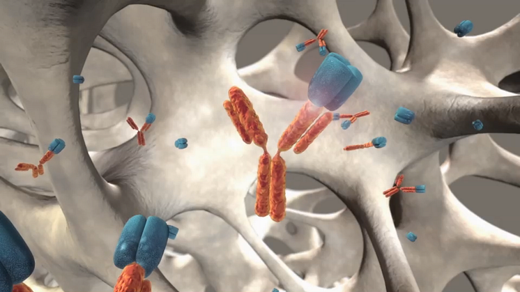 Nya data talar för att denosumab minskar risken för återfall i bröstcancer