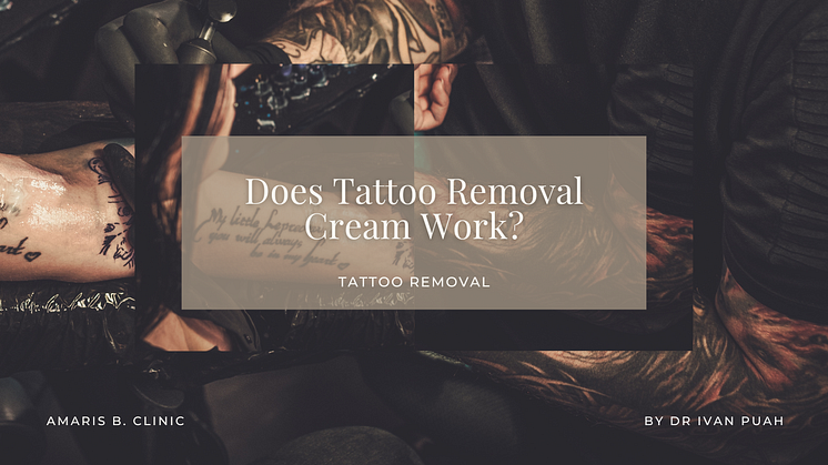 Does Tattoo Removal Cream Work?