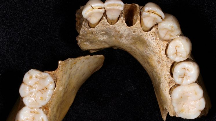 Neandertal_teeth