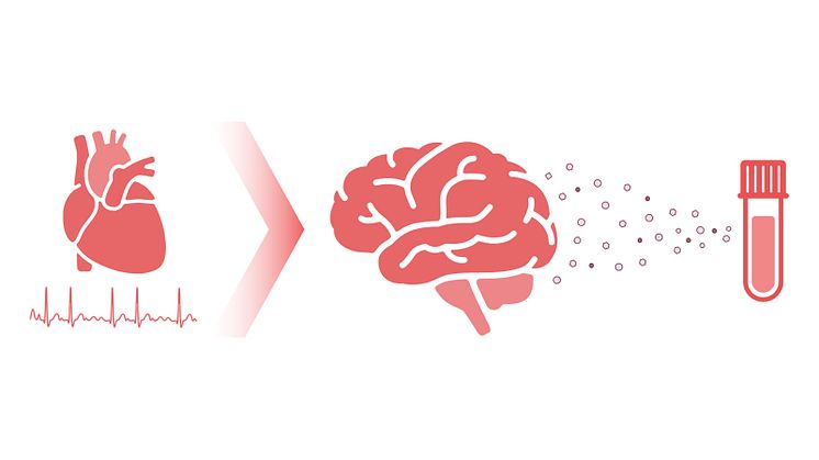 The researchers have analysed the substance neurofilament, a protein that is released from the brain in cases of injurious strain and hypoxia, in blood samples from more than three thousand people with atrial fibrillation. Illustration: Karl Sjölin