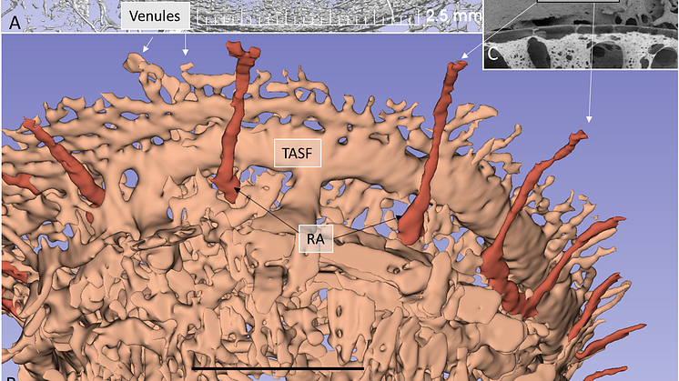 Cochlea blood vessel canals