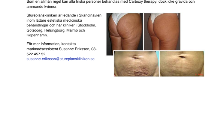 Stureplanskliniken – först i Skandinavien med Carboxy therapy: en ny metod för hudbristningar, celluliter, ärr och fett