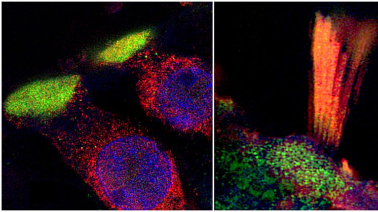 Proteins associated with hearing loss