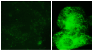 Flourescensmikroskopbild på brunfettsceller