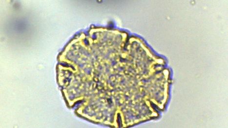 pollen sample.jpg