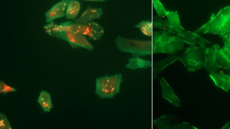 Nyupptäckta kemiska substanser kan verka mot Listeria-infektioner