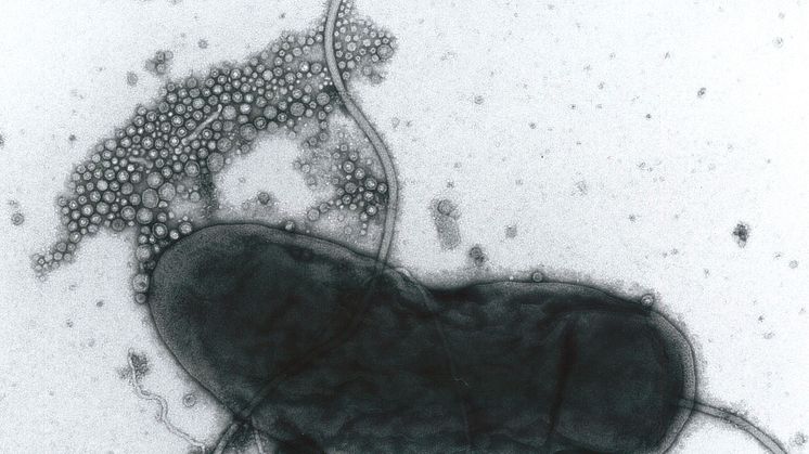 Kolerabakterier Vibrio cholerae utsöndrar membranevesiklar (membranpartiklar). Foto: Akemi Takade, Kyushu University, Japan.