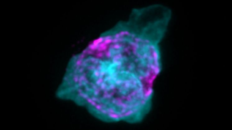 Vit blodkropp (magenta) som släpper ut NET-liknande strukturer (cyan). Immuncellen isolerades från en mus med CCM (cerebral cavernous malformation). Bild: Maria A. Globisch