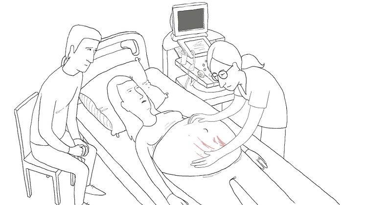 Multi award-winning filmmaker creates breech pregnancy animation