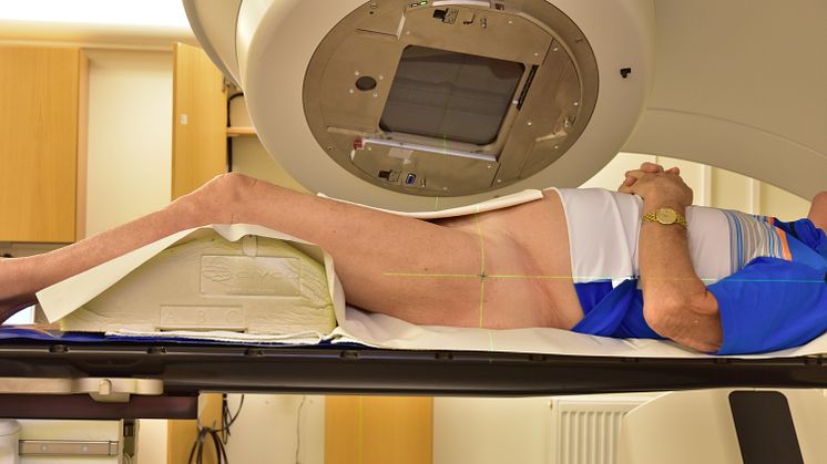 Patient med prostatacancer strålbehandlas vid Norrlands universitetssjukhus. Foto: Jan Johnson.