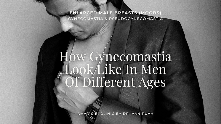 How Gynecomastia Look Like In Men Of Different Ages