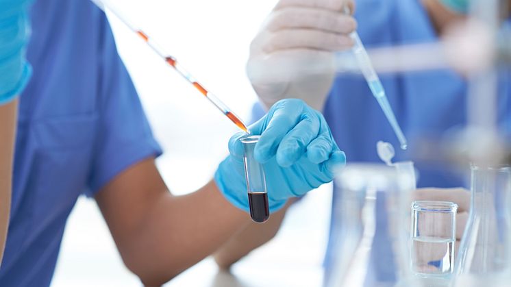Bioteknologirådet anbefaler NIPT-blodprøven som fosterdiagnostikk til kvinner over 38 år og til kvinner i risikogruppen. 