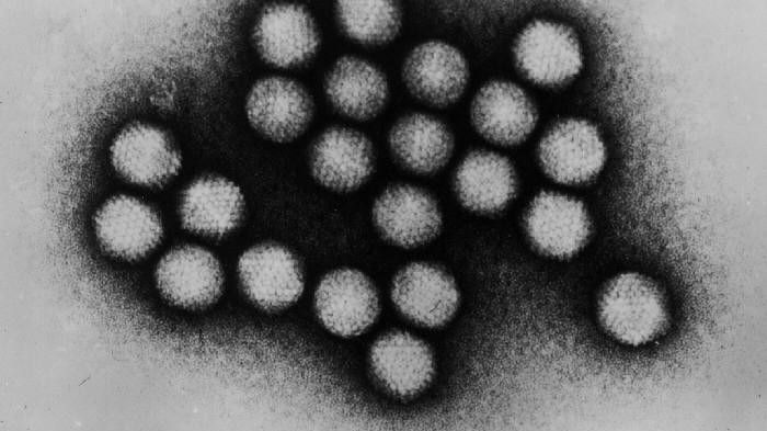Adenovirus (Foto: Wikipedia)