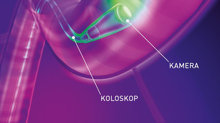 Darmspiegelung / Koloskopie - BESCHRIFTET