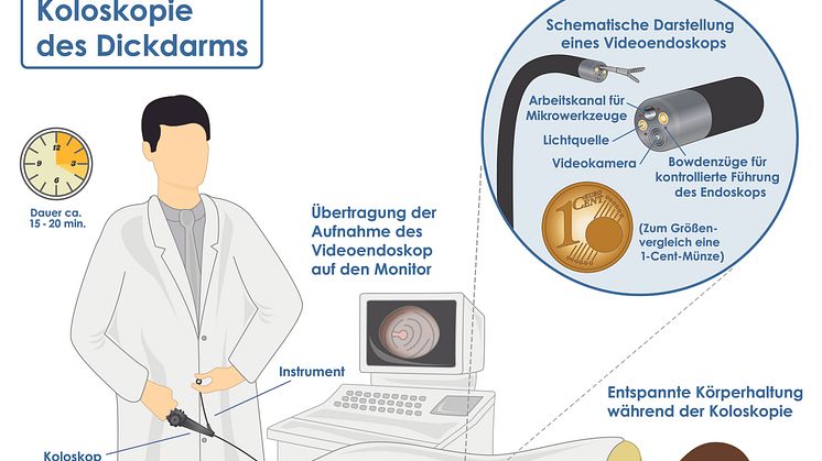 Darmspiegelung/Koloskopie des Dickdarms