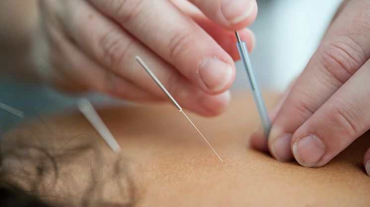 Akupunktur behandling og dets potentiale