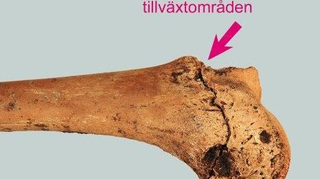 Bilden visar två av Hallonflickans ben på Falköpings museum. Hon levde för 5000 år sedan. Kan vi säga något om hennes ålder?
