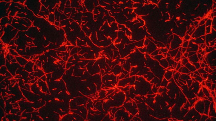 Innan sommaren lanserades projektet ”Stoppa Legionella”, den första informationsportalen på nätet med samlad information om bakterien och sjukdomarna som den orsakar, www.stoppalegionalla.se.