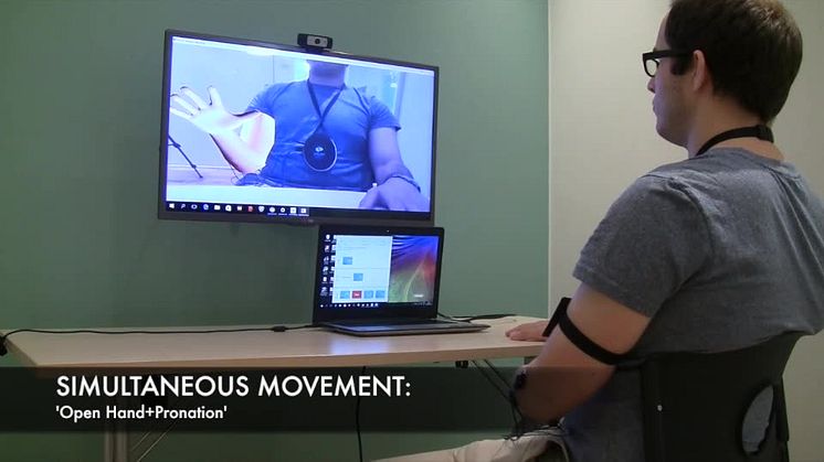 Phantom movements in augmented reality helps patients with chronic intractable phantom limb pain