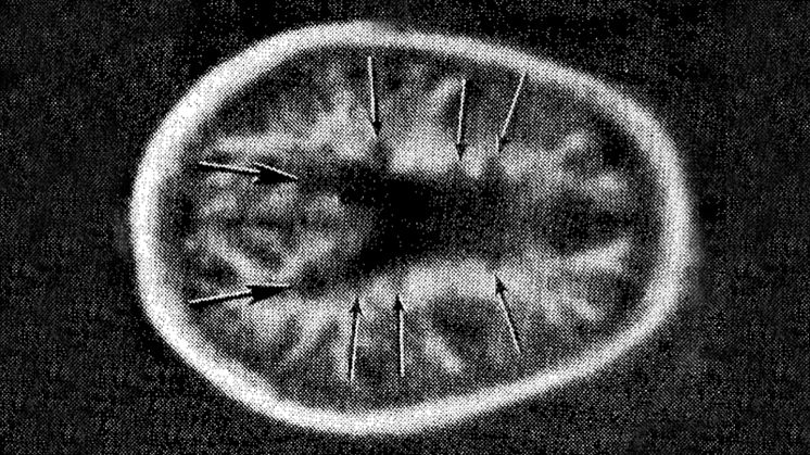 Young-MRI-MS-1981_fig5
