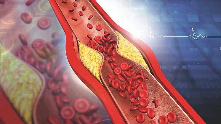 Zeitkritische Untersuchung: Bei der Diagnose krankhafter Veränderungen der Herzkranzgefäße in Form von Verengungen und Plaques können Zeitverluste zur Gefahr für Patienten werden.