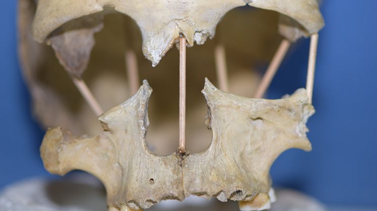 The skull of Peştera Muierii 1, which entire genome is now successfully sequenced. Photo: Mattias Jakobsson