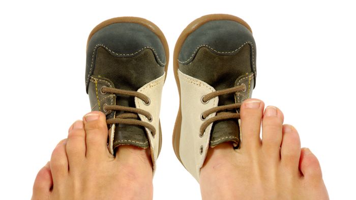 Druckstellen und Geschwüre vermeiden: Ursache ist oft falsches Schuhwerk