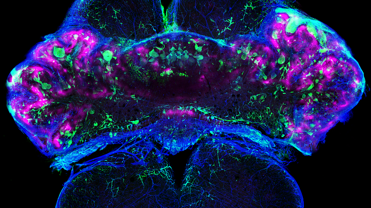 A brain from a mouse with CCM3 disease showing regions in the brain that lack oxygen (hypoxia, magenta) due to blood vessels (collagen IV, blue) that are occluded with coagulated blood (fibrin, green). Photo: Fabrizio Orsenigo/Maria Globisch