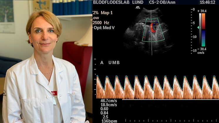Jana Brodszki, överläkare inom kvinnosjukvård på Skånes universitetssjukhus är ansvarig för den svenska delen av studien TRUFFLE 2..