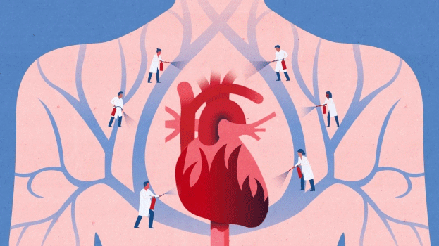 Dödstalen i hjärt-kärlsjukdomarna sjunker, men allt fler lever med allvarliga riskfaktorer för hjärt-kärlsjukdom.