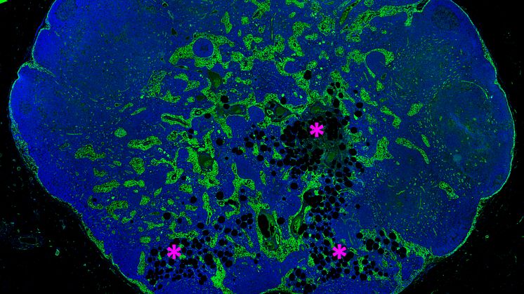 Immunofluorescensfärgning av en human lymfkörtel med tidig lipomatos (fett) lokaliserad till medullära delen av lymfkörteln. Bild: Tove Bekkhus 
