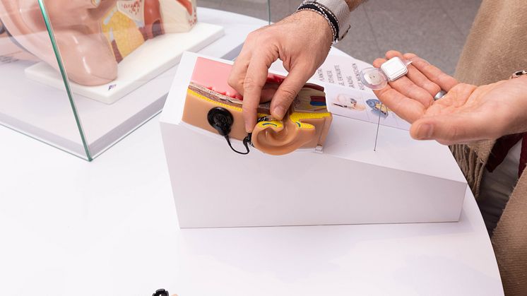 Gehirn und elektrisch stimuliertes Hören – auch neueste Hörimplantate von Cochlear werden in der Ausstellung vorgestellt (Foto: Bundeskunsthalle)