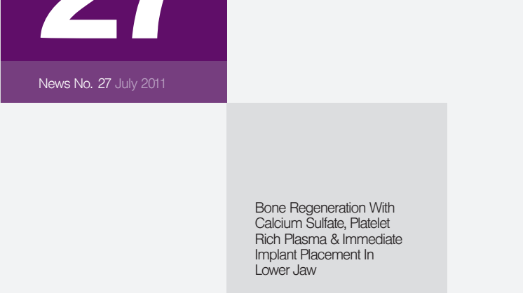 Bone Regeneration With Calcium sulfate Platelet Rich Plasma & Immediate Implant Placement in Lower Jaw