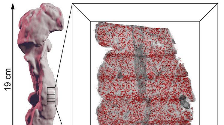 Illustration av hur en bukspottkörtel kan delas i mindre delar som färgas in för specifika celltyper med de insulininfärgade Langerhanska cellöarna i rött, som sedan sättas samman i en dator som ett tredimensionellt pussel.