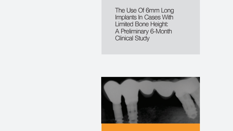 The use of 6mm long implants in cases with limited bone hight