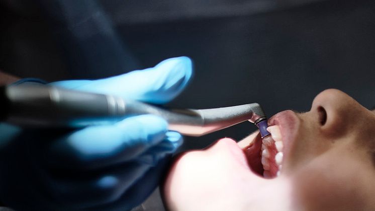 Placerade barn har sämre tandhälsa och mindre tillgång till tandvård