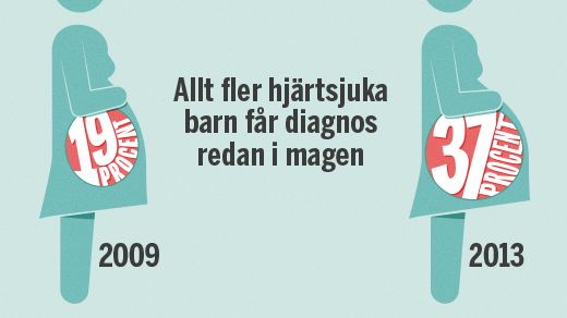 Hjärtrapporten 2015: Fler diagnoser ställs under fosterstadiet