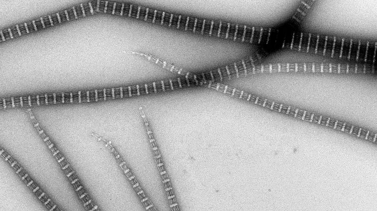 Elektronmikroskopibild på streptomyces-protein. Bild: Linda Sandblad