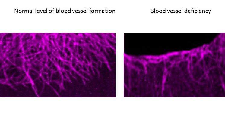 Mechanism for the formation of new blood vessels discovered