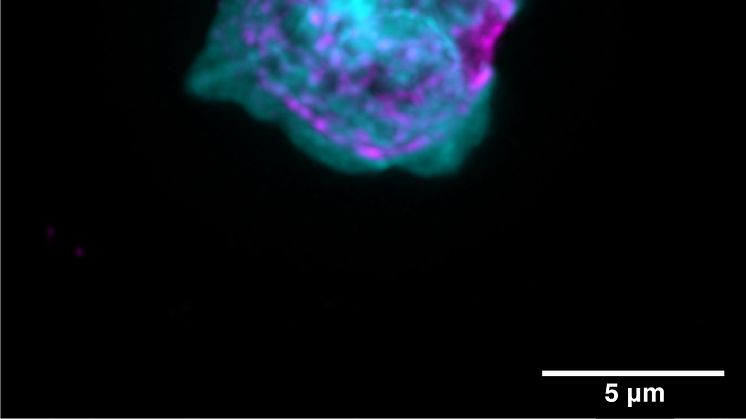 Immune cell isolated from mouse with CCM 