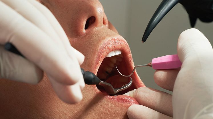 40 procent af Danmarks voksne befolkning – svarende til over 2,3 millioner mennesker – lider af varierende grader af parodontitis, men kun omkring 12-14 procent er i behandling herfor.