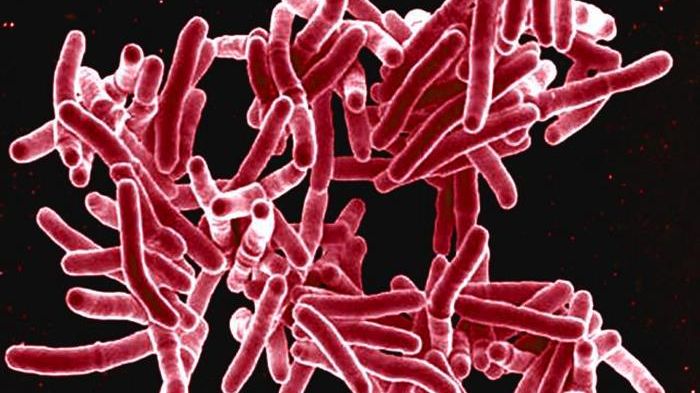 Bakterien Mycobacterium tuberculosis som orsakar tuberkulos hos människan. Foto: National Institute of Allergy and Infectious Diseases 