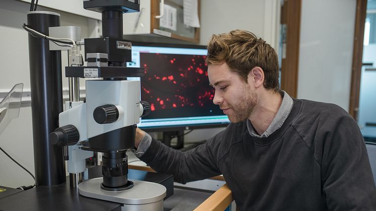   Max Hahn, doktorand vid Umeå centrum för molekylär medicin, studerar vävnadsmaterial med fluorescerande ljusfältsmikroskop. Foto: Mattias Petterson