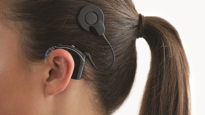 Cochlear™ Nucleus® 7 Soundprozessor