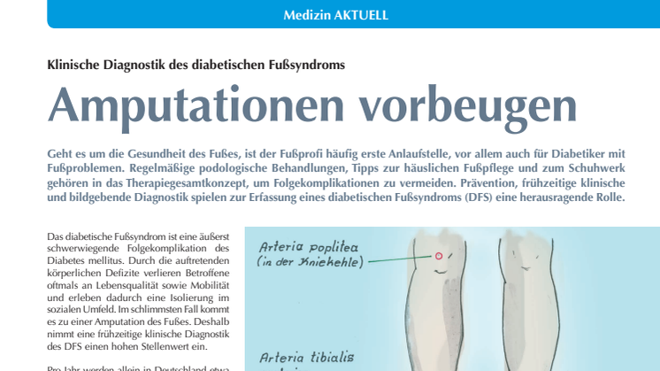 Amputationen vorbeugen: Klinische Diagnostik des diabetischen Fußsyndroms