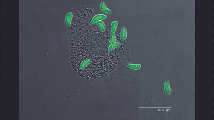 Toxoplasma gondii och en immuncell.