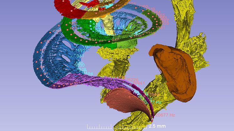 Ear membrane and auditory nerve in the cochlea. Humans can perceive frequencies from 20 Hz (the top of the coil) to 20,000 Hz (the base of the coil). Credit: Hao Li