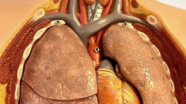 Första pilotstudien i Sverige om lungcancerscreening